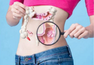 Đau hông trái do nhiều nguyên nhân gây ra